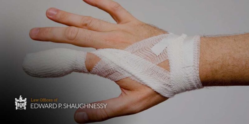 sprained finger vs broken