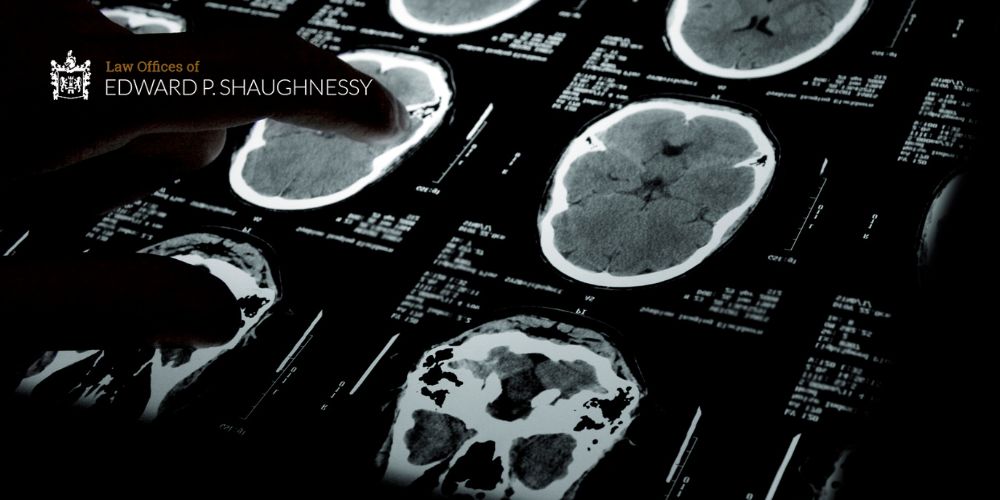 10 Stages of Brain Injury Recovery