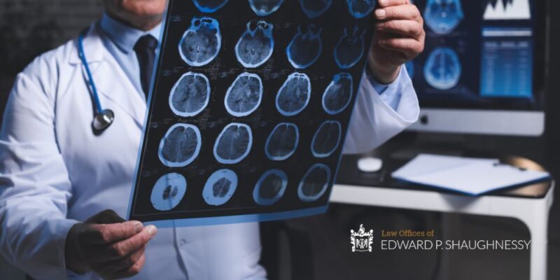 Easton, PA Brain Injury Lawyer