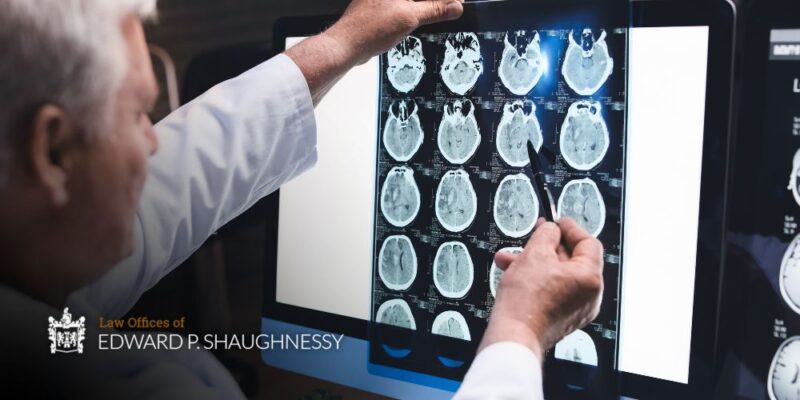 What is Post-Concussion Syndrome